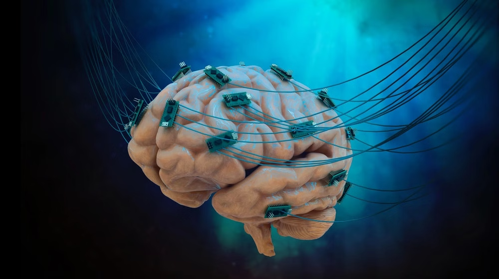 Brain Chip Startup Prepares First-Ever Human Implant Trial in the US